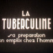 La Tuberculine